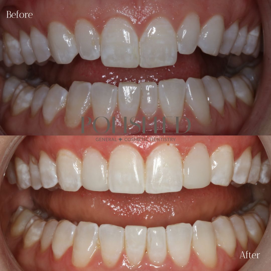 Polished B n A's (1)